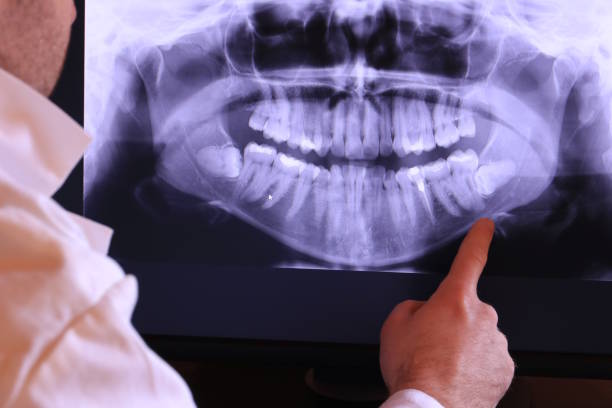 Best Emergency Treatment for Dental Infections or Abscesses in Moody, AL