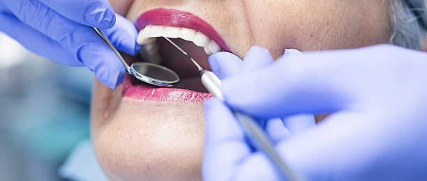 Best Emergency Wisdom Teeth Removal in Moody, AL